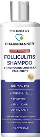 Our Recommended Choice of Itchy Scalp Help Product